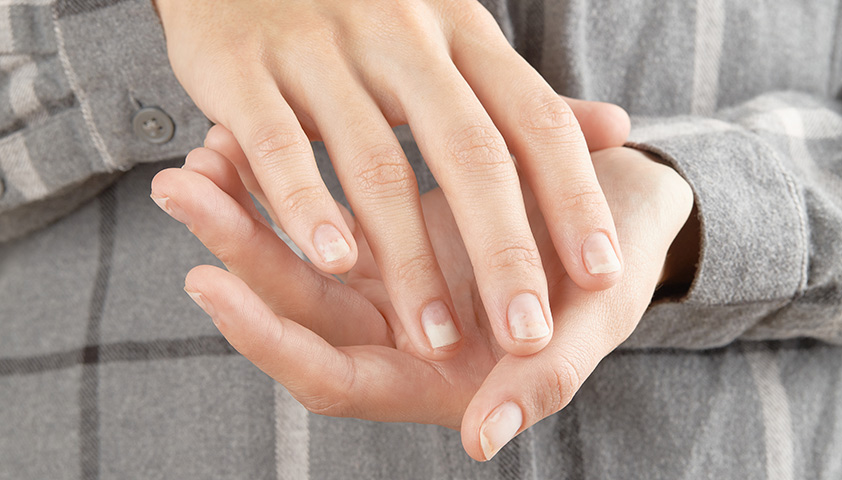 Онихолизис