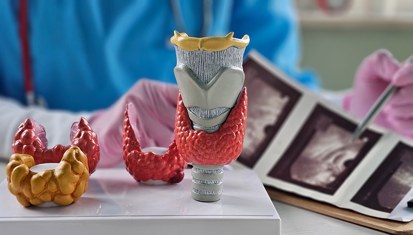 Тиреотоксикоз