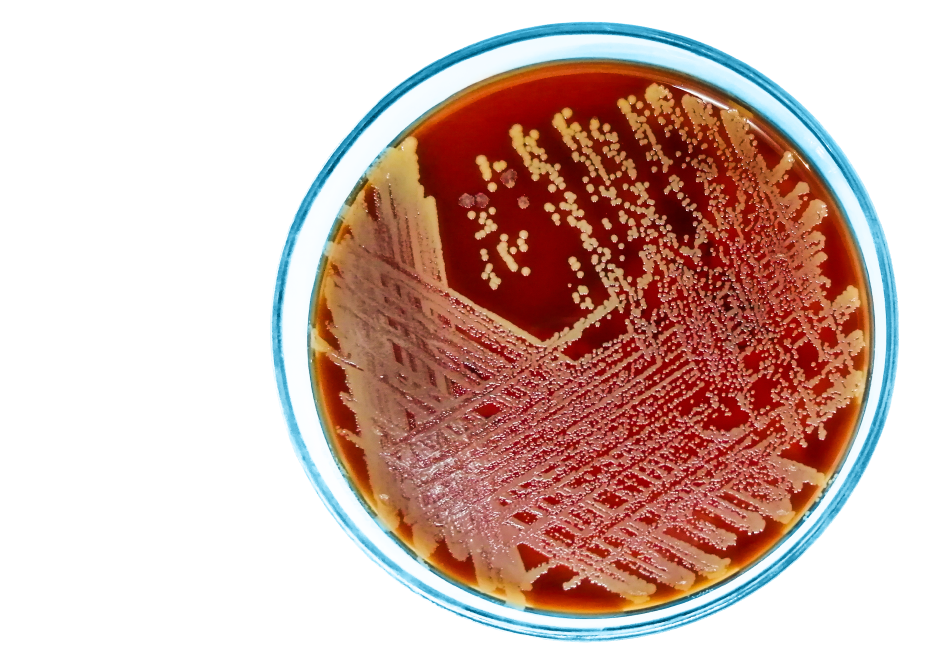 Посев на золотистый стафилококк (S. aureus), количественный результат