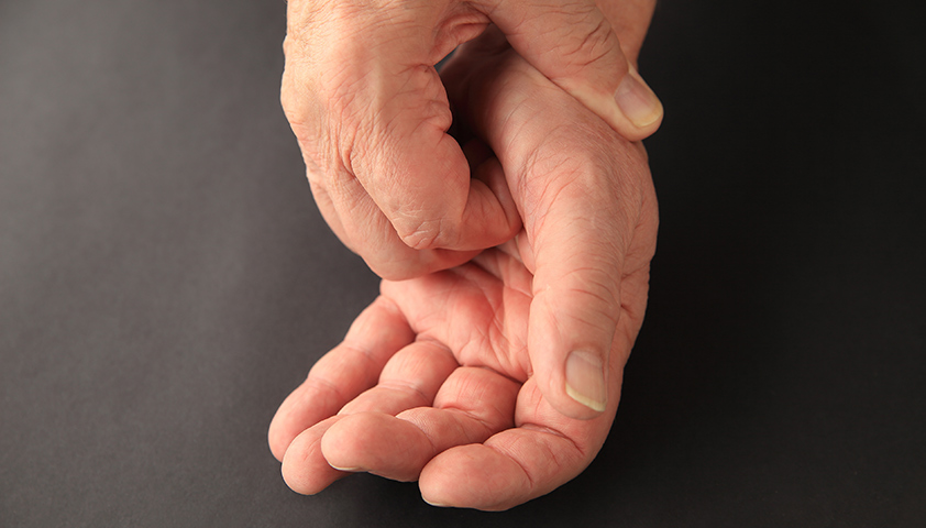 Экзема на руках: фото, лечение, причины и как она выглядит на пальцах