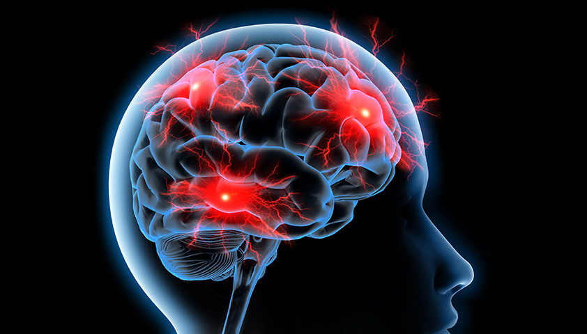 Энцефалопатия