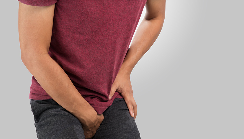 Варикоцеле