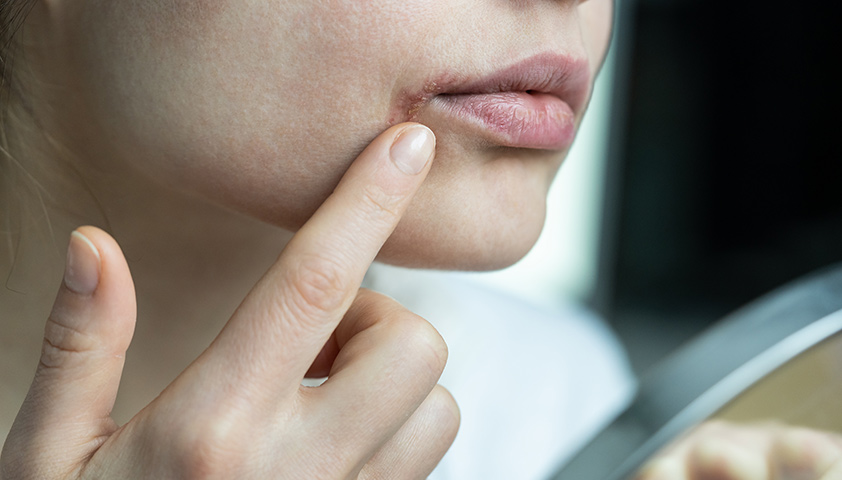 Почему рот оказывается в говне: причины и механизмы