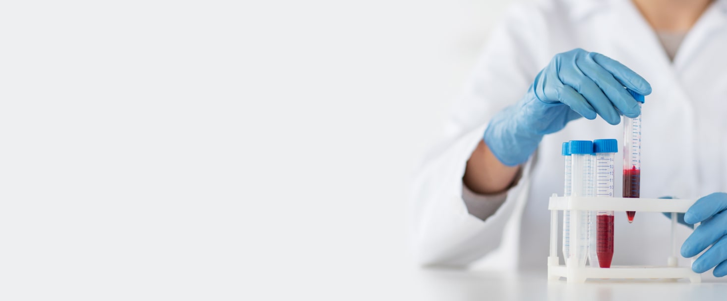 Креатинин в сыворотке крови (венозная кровь) сдать