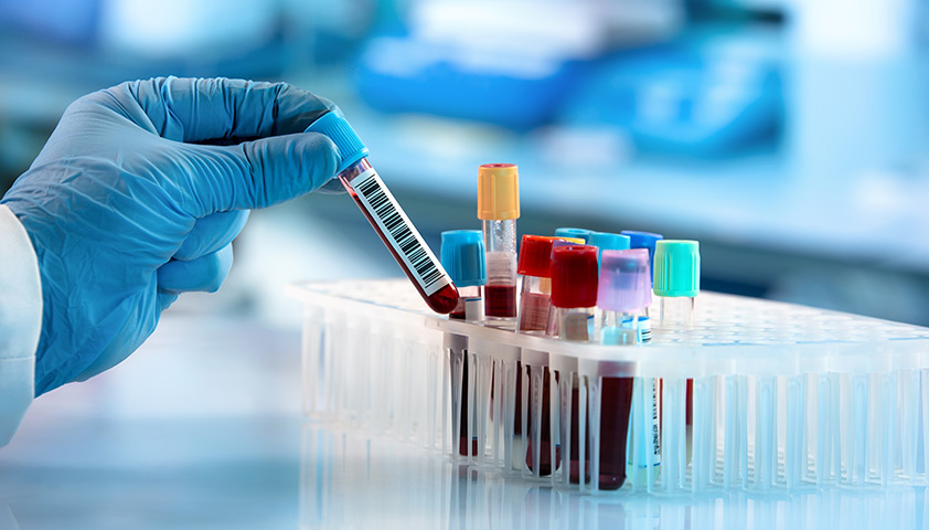 Можно ли определить онкологию по анализу крови