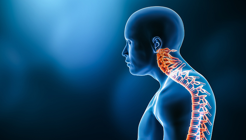 Патологический кифоз