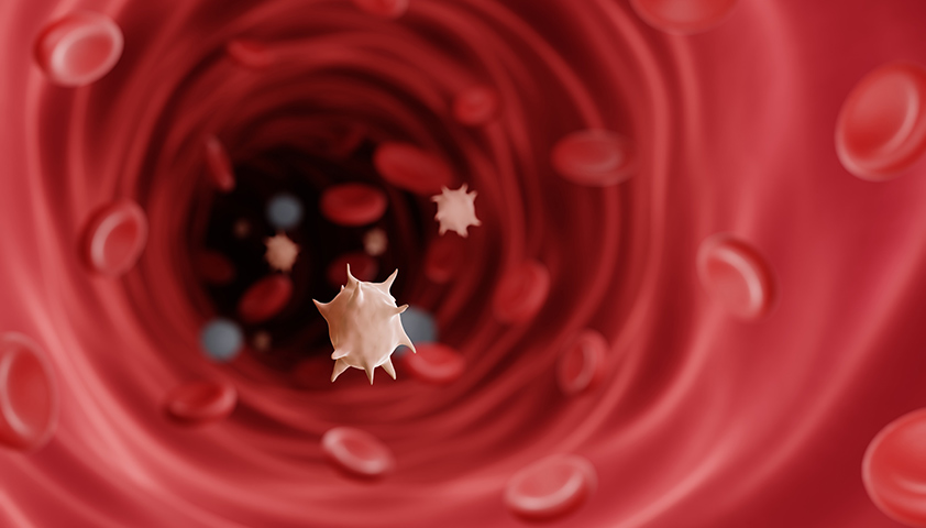 Тромбоцитопения