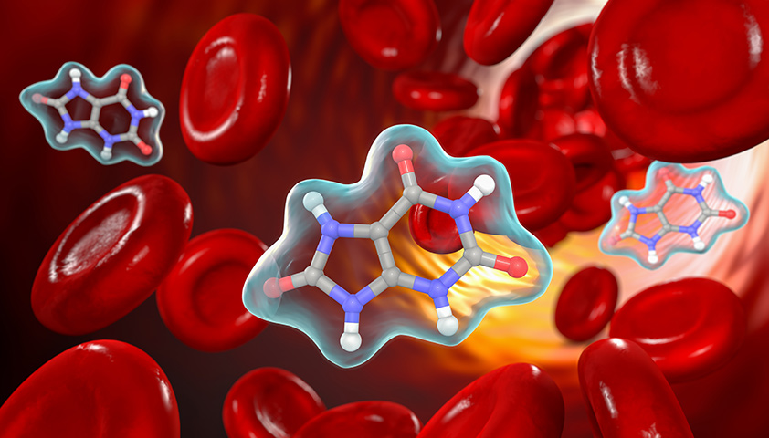 Гиперурикемия