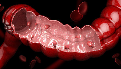 Кровь в кале: причины и особенности при разных заболеваниях, диагностика в Анапе