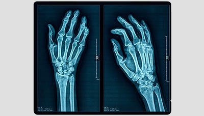 Рентген-руки
