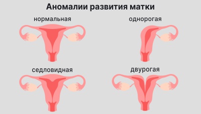 Как определить срок беременности