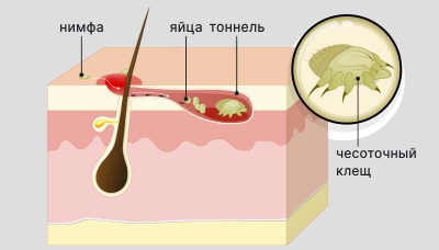 Черви в кровати во сне