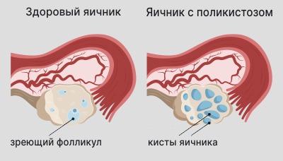        MedTour