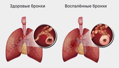острые и жареные продукты