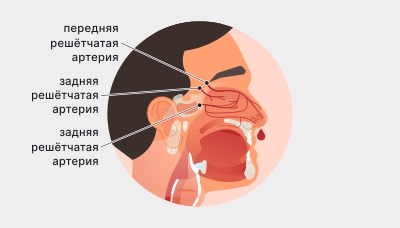 Причины крови из горла: возможные причины и что делать