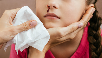 Почему кровь из носа идет из одной ноздри у взрослого: причины и лечение