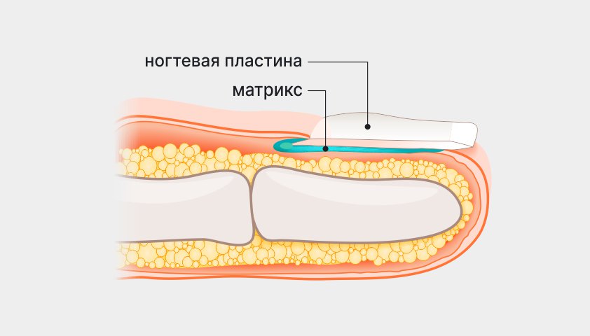 Поврежден матрикс что делать