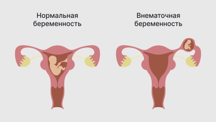 Головокружение тошнота частый стул