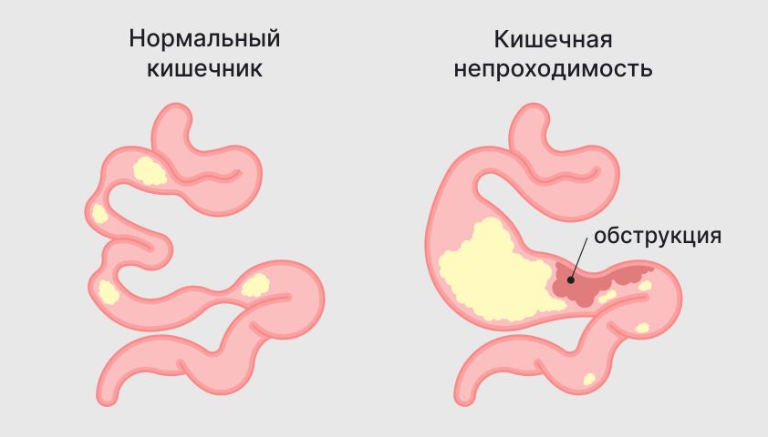 Головокружение тошнота частый стул