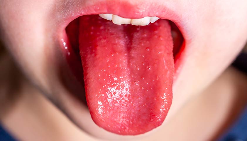 Язык мой — врач мой? О каких болезнях можно узнать по органу вкуса.