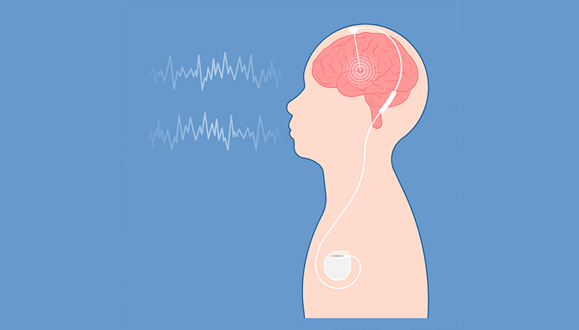 Болезнь паркинсона