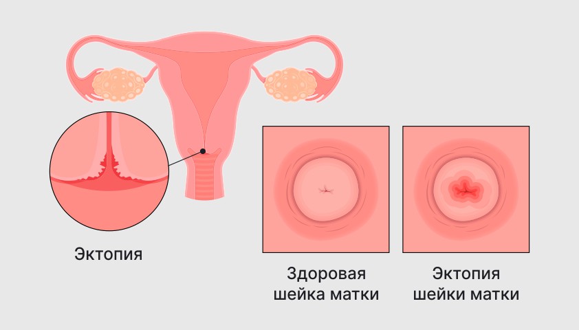 Atlas of visual inspection of the cervix with acetic acid for screening  triage and assessment for treatment