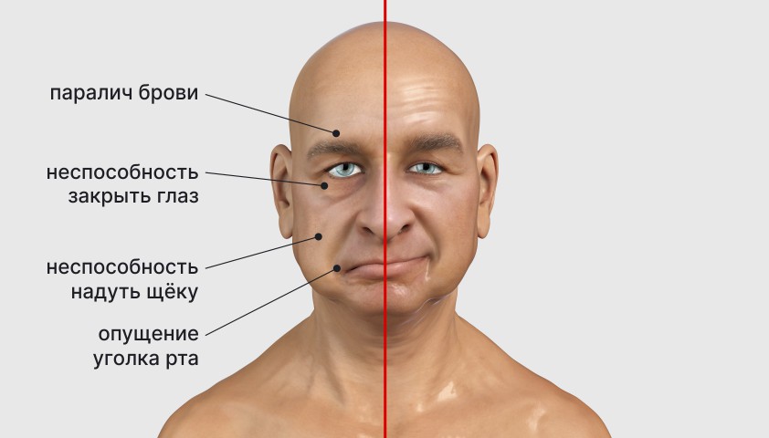 Психологическая помощь