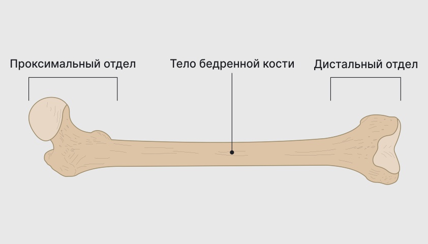 Где находится шейка бедра у человека фото