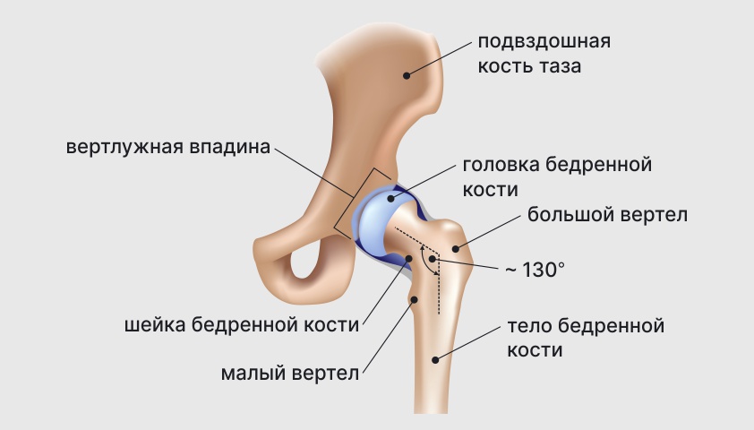 Эндопротезирование бедренной кости. Переломы тазобедренного сустава классификация. Анатомическая шейка бедра. Трещина в тазобедренном суставе симптомы.