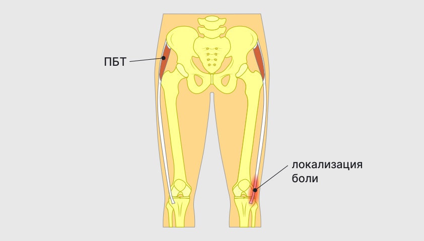 Колени болят при сгибании