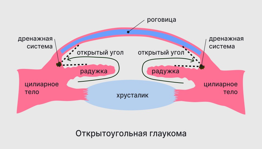 Открытоугольная глаукома лечение. Механизм амебоидного движения. IGF-1. Механизм развития эрекция. Направление движения амебы.