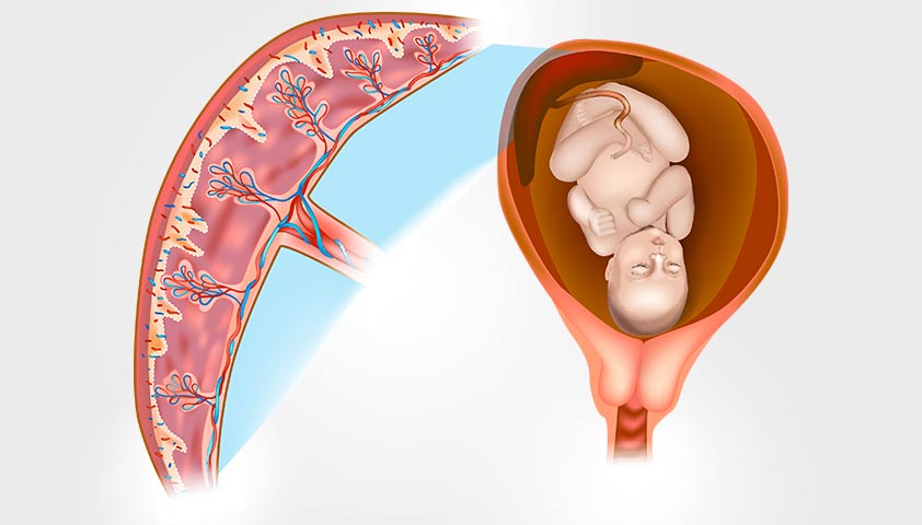Низкая плацента при беременности: симптомы и чем опасна