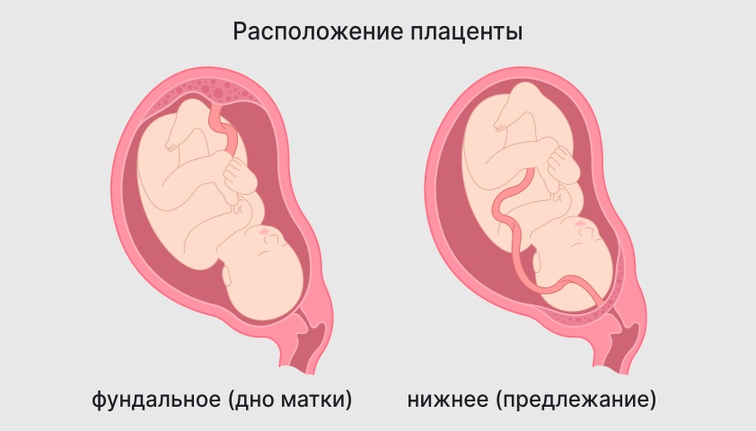 Плотный тяж соединяющий зародыш с плацентой. Плацента картинка для презентации. Низкая плацентация. Система мать-плацента-плод.