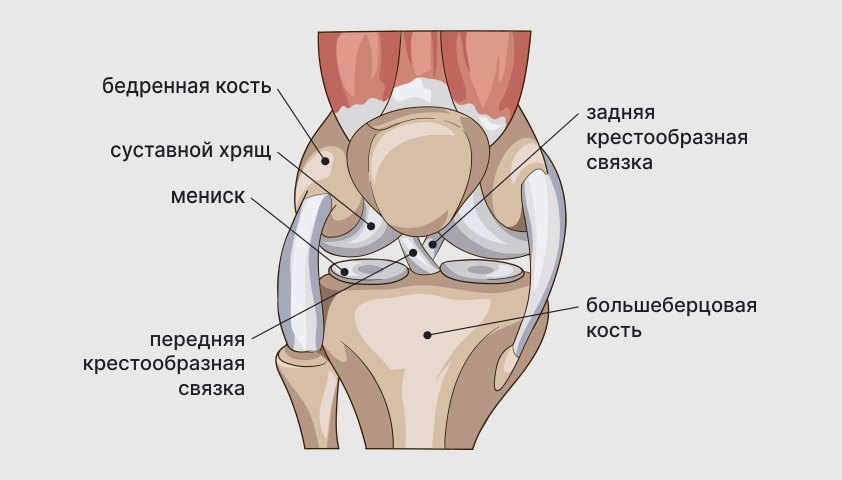 Артроз коленного сустава ✔️: симптомы, причины, диагностика и лечение