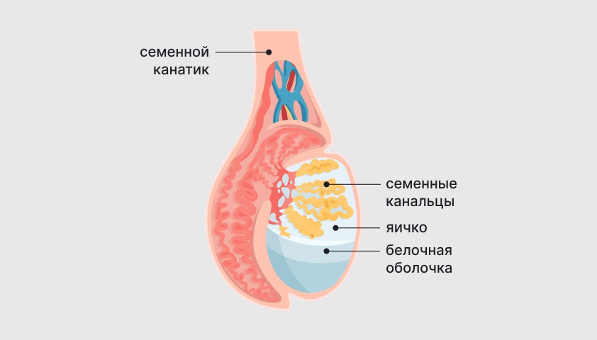 Рак придатка яичка: причины, симптомы и лечение в статье онколога Генс Г. П.