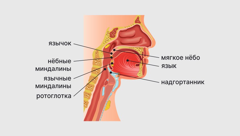 Рак гортани