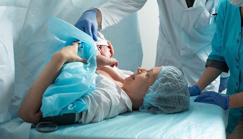 Кесарево сечение