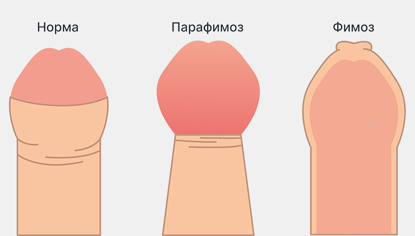 Yaros фильмінің эротикалық кастингі онлайн видеоның барлық эпизодтарын HD форматында қараңыз