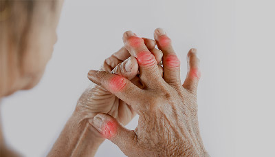 Инкубационный период для трихомоноза Инкубационный период для трихомоноза