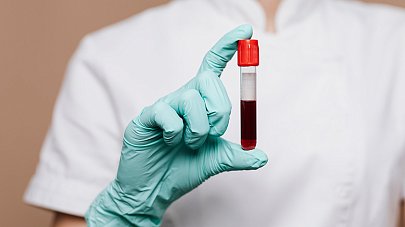 Анализы на магний