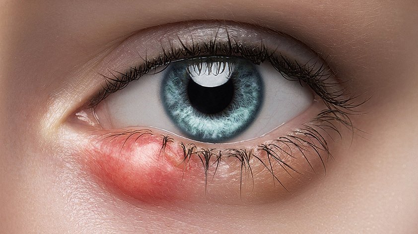 Причины заболеваний глаз