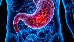 Гастродуоденит