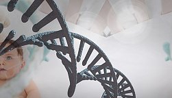 Синдром Ретта