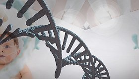 Синдром Ретта