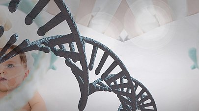 Синдром Ретта