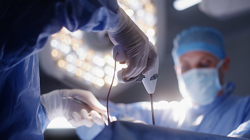 Лапароскопия