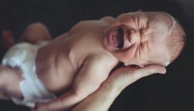 Синдром кошачьего крика