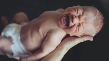 Синдром кошачьего крика