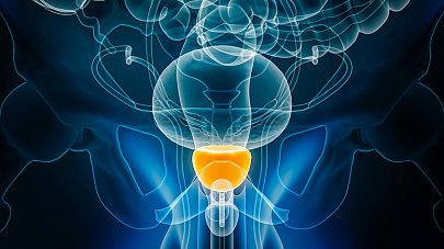 Предстательная железа (простата)