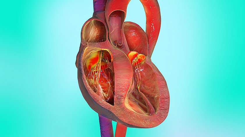 Гипертрофия миокарда